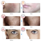 Rechargeable 7-Color LED Facial Mask – Skin Rejuvenation & Face Lifting Beauty Device for Home Use