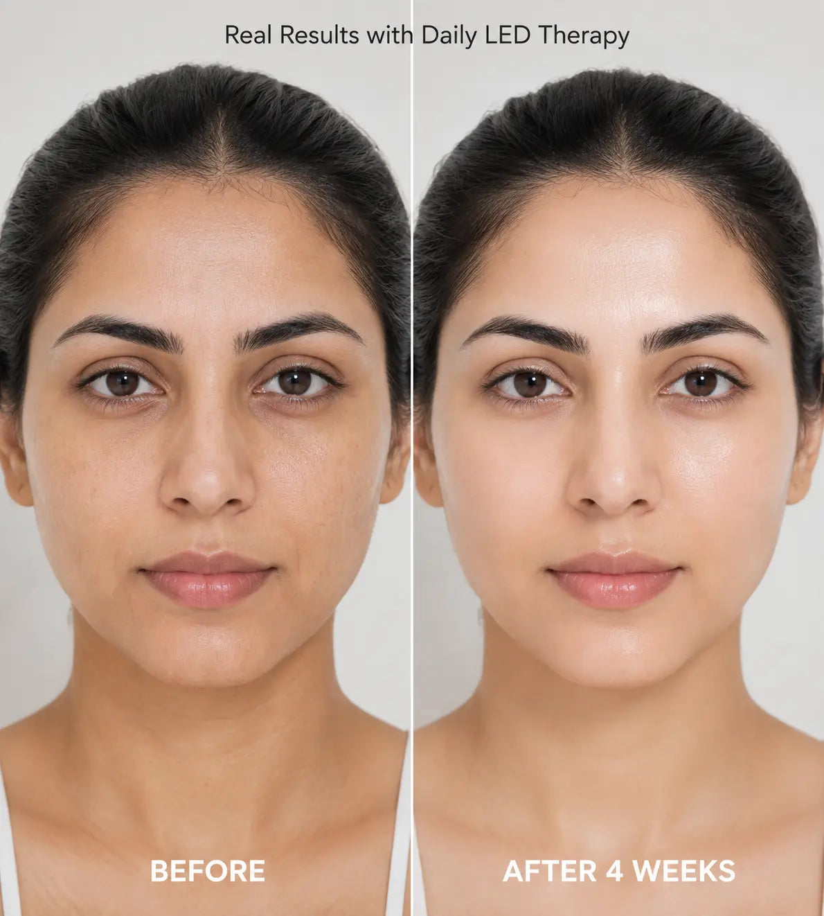 LED Facial Mask – Reduce Wrinkles, Acne & Dark Spots at Home